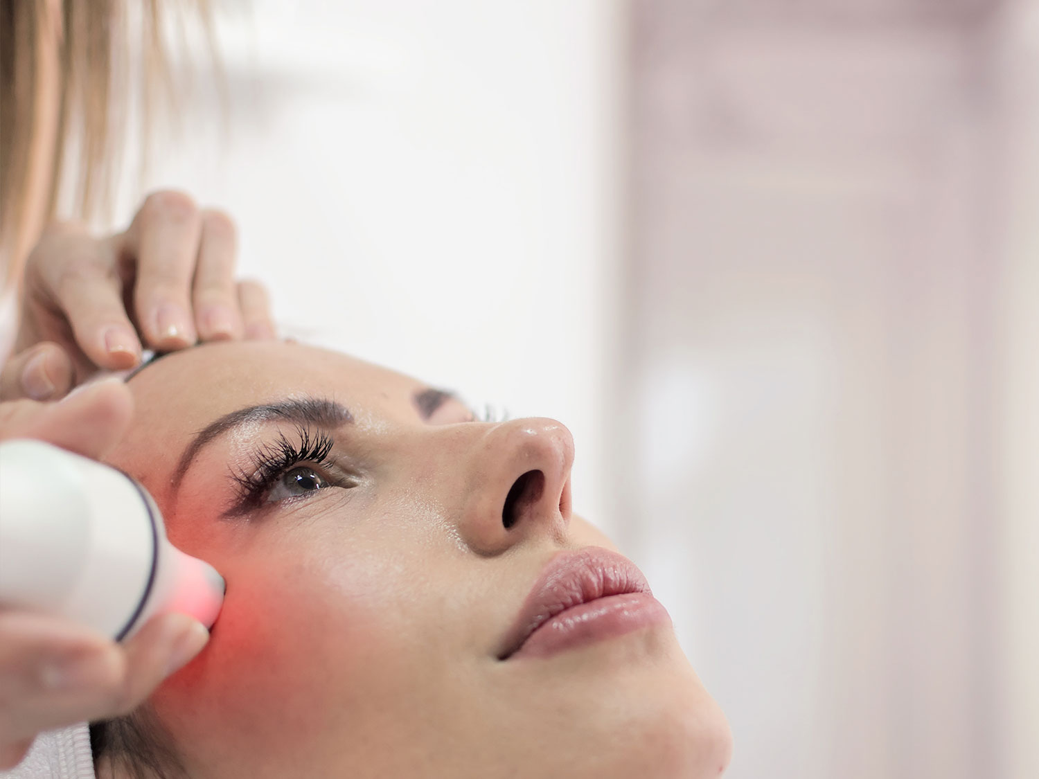 laser-treatment-los-angeles